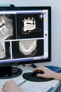 orthodontic scan